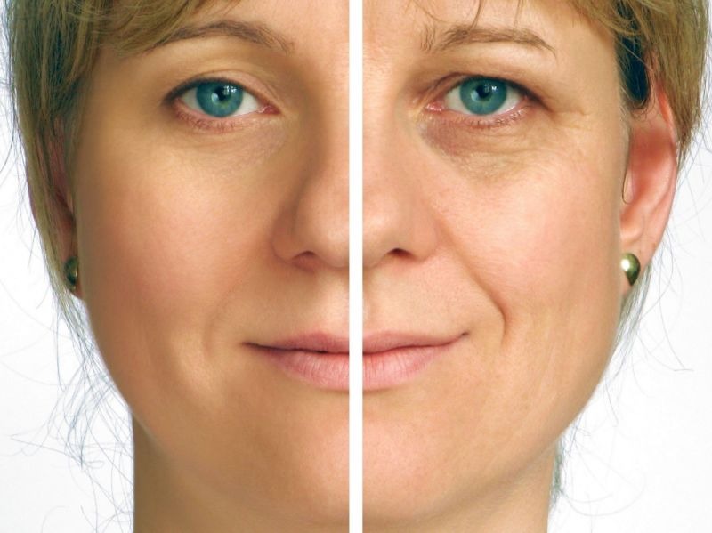 Transform Your Look with Premium Dermal Fillers in Beverly Hills